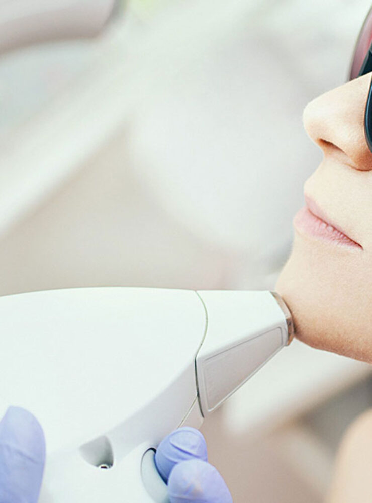 Depilación láser facial